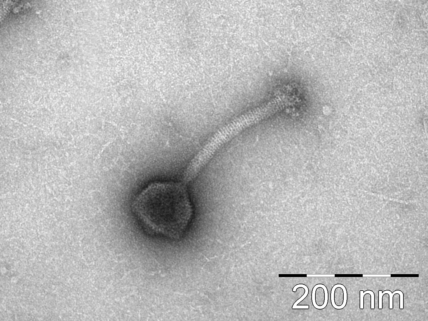 Listeria Phage SiL2, vom PTC Phage Technology Center GmbH, Bild wurde am MRI (FS2) gemacht